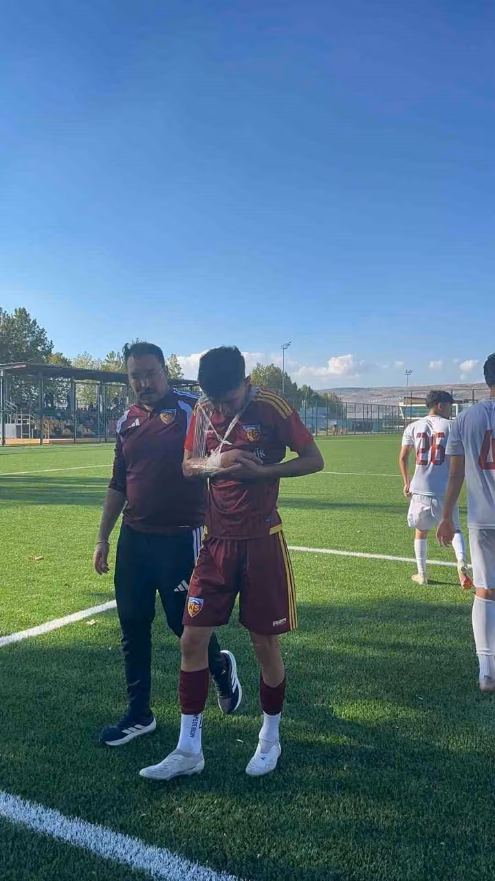 Kayserispor U19’da Hilmi Türkan’dan kötü haber